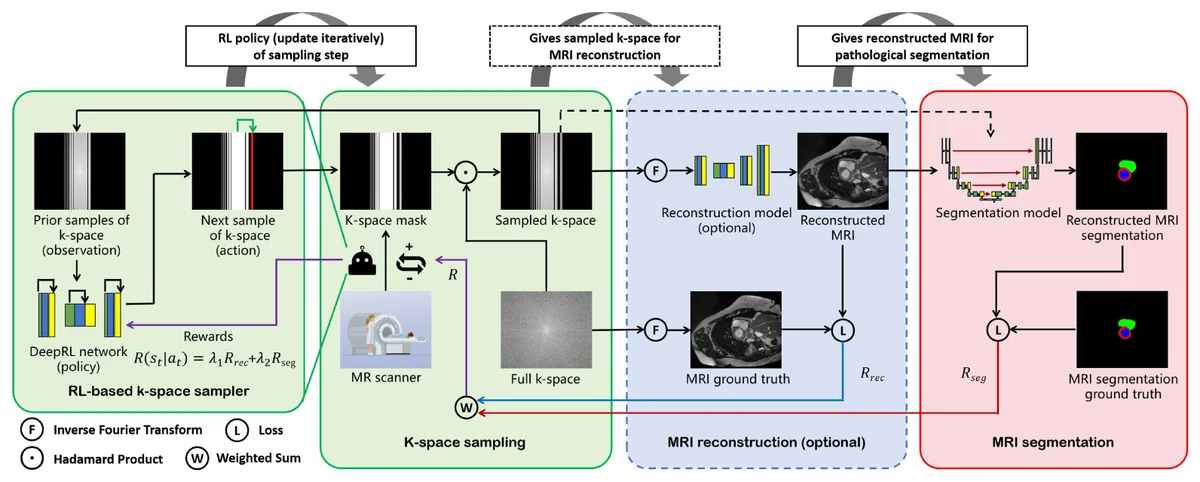 Reinforcement learning pipeline for adaptive K-space sampling and medical image segmentation